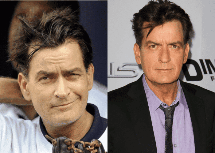 Male Celebrities Wearing Toupees Due to Hair Loss| Newtimeshair