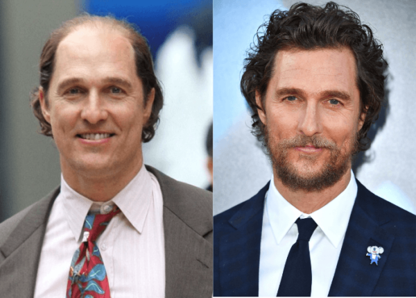 Male Celebrities Who Wear Toupees And Wigs Due To Hair Loss 8703