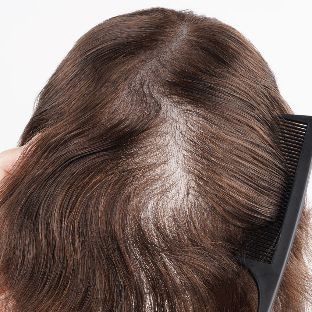 LIGHT03 dünnhäutiges Haarsystem bei ideal leichter Haardichte